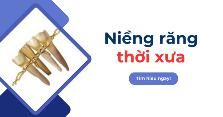 niềng răng thời xưa