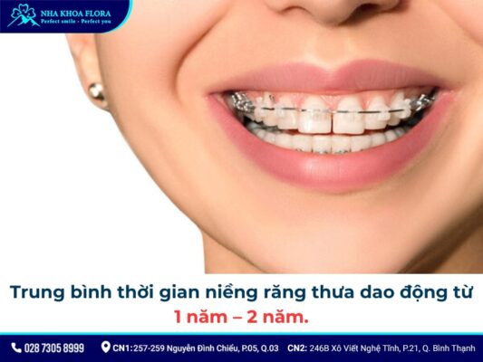 niềng răng thưa - ảnh 3