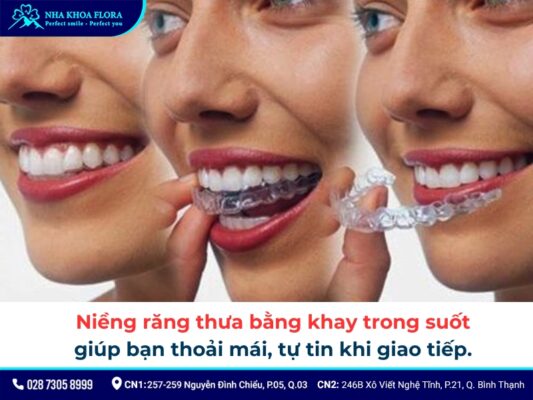 niềng răng thưa - ảnh 5