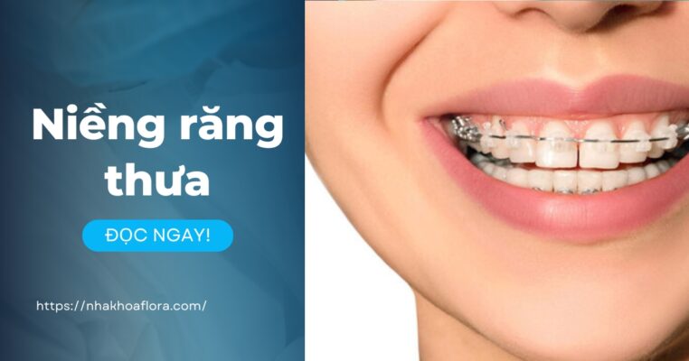 niềng răng thưa