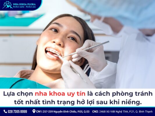 niềng răng xong bị cười hở lợi - ảnh 5