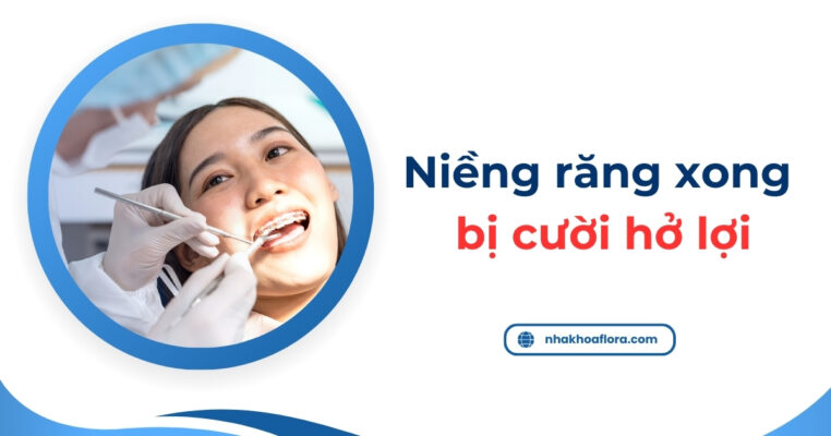 niềng răng xong bị cười hở lợi