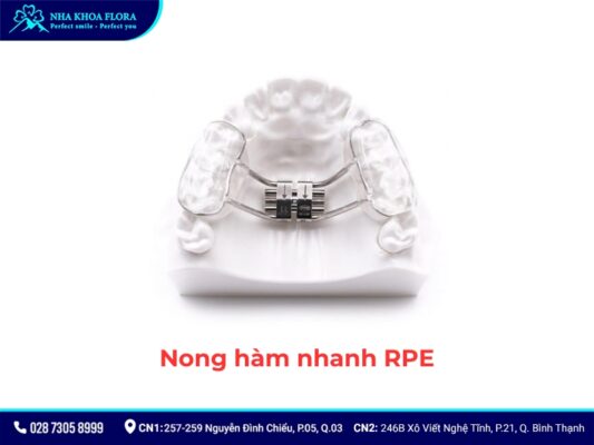 nong hàm niềng răng - ảnh 3