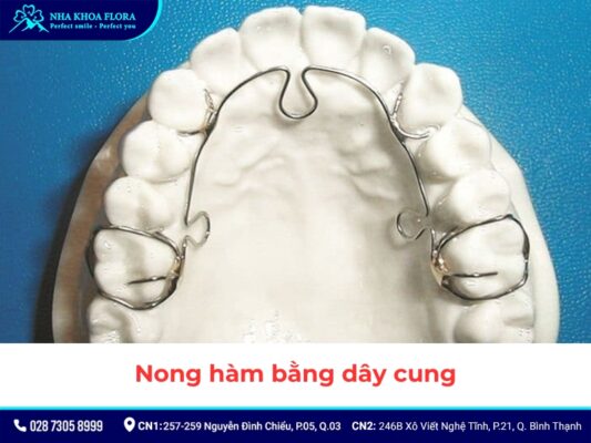 nong hàm niềng răng - ảnh 4