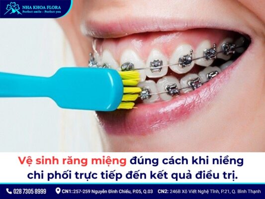 cách dùng chỉ nha khoa khi niềng răng - ảnh 1