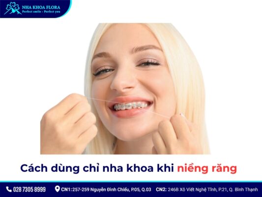 cách dùng chỉ nha khoa khi niềng răng - ảnh 5