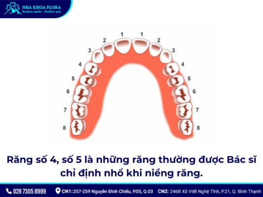 nhổ 4 răng để niềng răng - ảnh 2