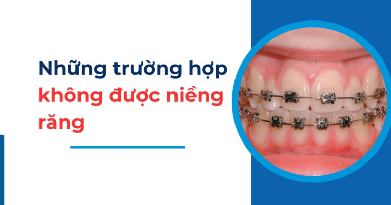 những trường hợp không được niềng răng