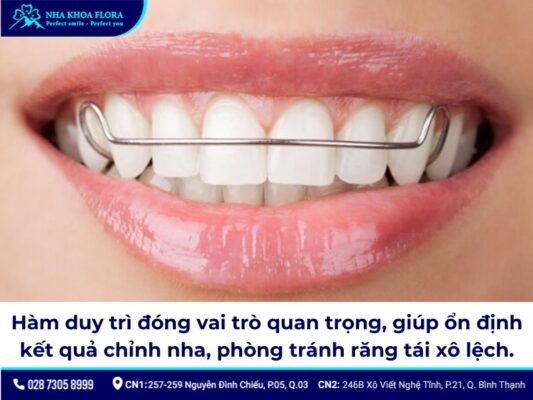 niềng răng có bị hô lại không - ảnh 2