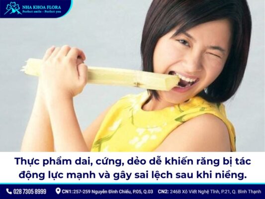 niềng răng có bị hô lại không - ảnh 3