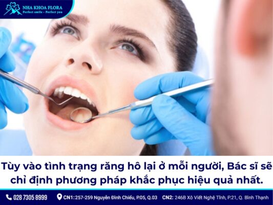 niềng răng có bị hô lại không - ảnh 5