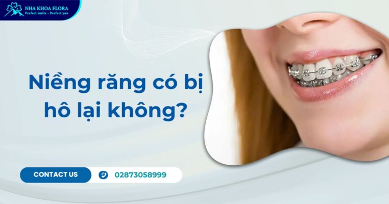niềng răng có bị hô lại không