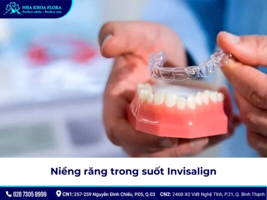 niềng răng có được vĩnh viễn không - ảnh 5