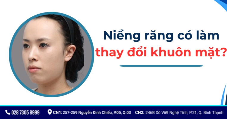 niềng răng có làm thay đổi khuôn mặt