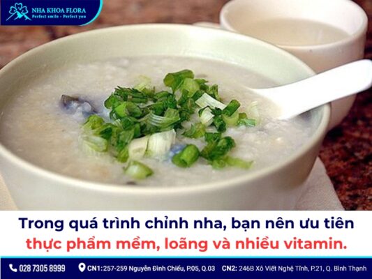 niềng răng có nên uống nước lạnh - ảnh 5