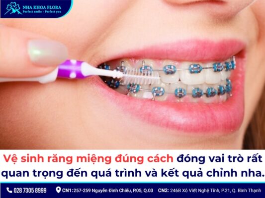 niềng răng có nên uống nước lạnh - ảnh 6