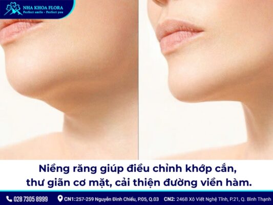 niềng răng có thay đổi xương hàm - ảnh 2