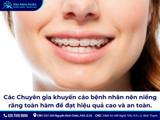 niềng răng cửa thưa - ảnh 1