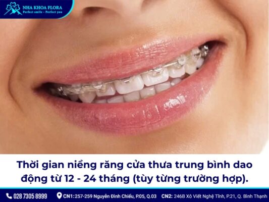 niềng răng cửa thưa - ảnh 7