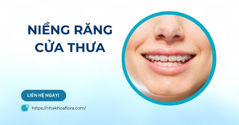 niềng răng cửa thưa