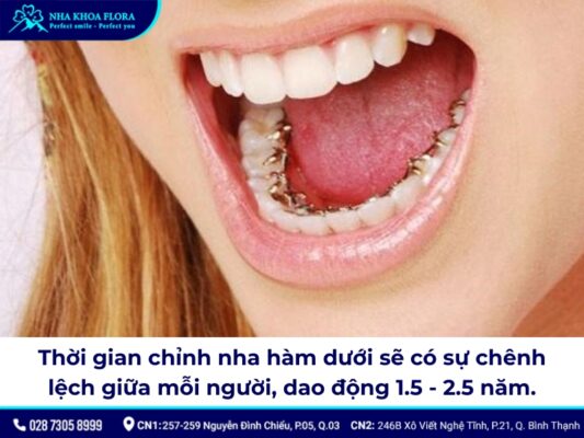 niềng răng hàm dưới - ảnh 3