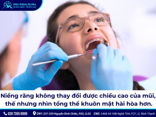 niềng răng mũi có cao lên không - ảnh 1