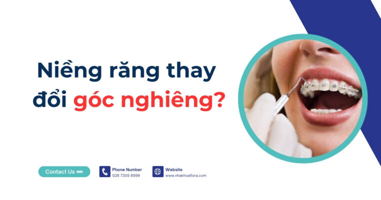 niềng răng thay đổi góc nghiêng