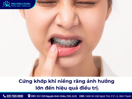 tác hại của niềng răng - ảnh 4