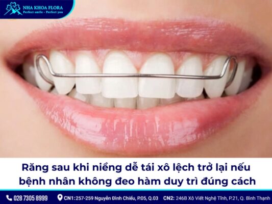 tác hại của niềng răng - ảnh 5