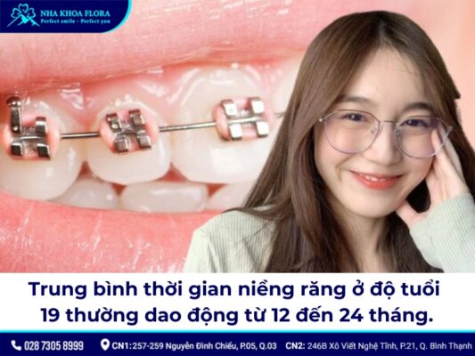 19 tuổi niềng răng bao lâu - ảnh 1