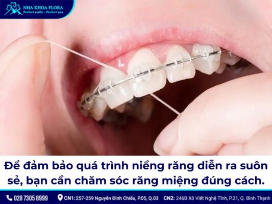 19 tuổi niềng răng bao lâu - ảnh 4