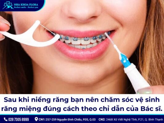 22 tuổi niềng răng được không? - ảnh 5