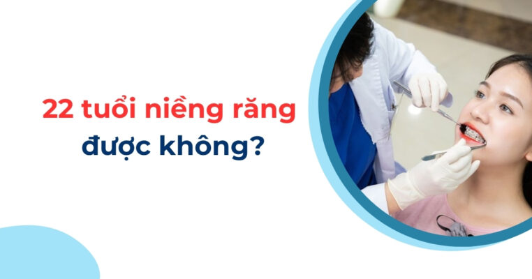 22 tuổi niềng răng được không