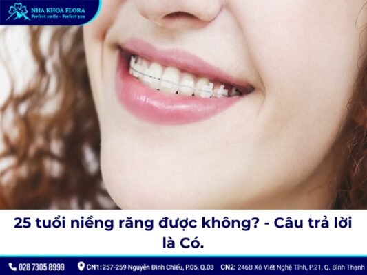 25 tuổi niềng răng được không - ảnh 2