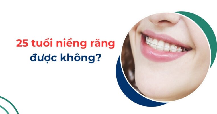 25 tuổi niềng răng được không