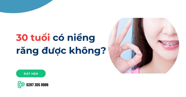 30 tuổi có niềng răng được không