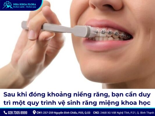 đóng khoảng trong niềng răng – ảnh 7