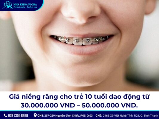 giá niềng răng cho trẻ 10 tuổi - ảnh 1