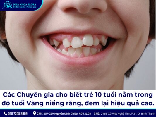giá niềng răng cho trẻ 10 tuổi - ảnh 2