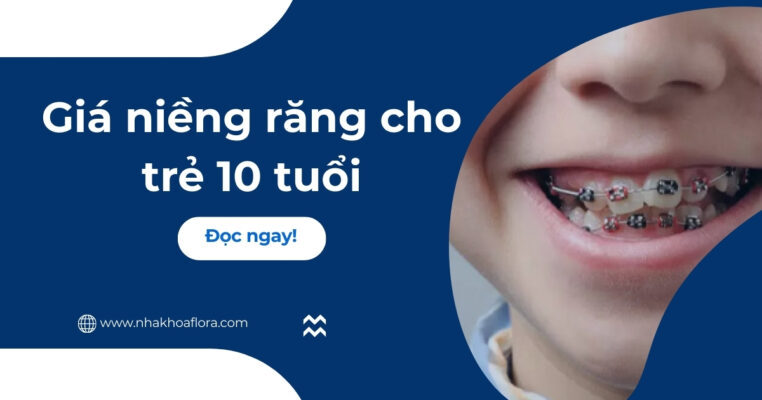 giá niềng răng cho trẻ 10 tuổi