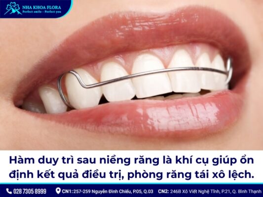 hàm duy trì sau niềng răng - ảnh 1