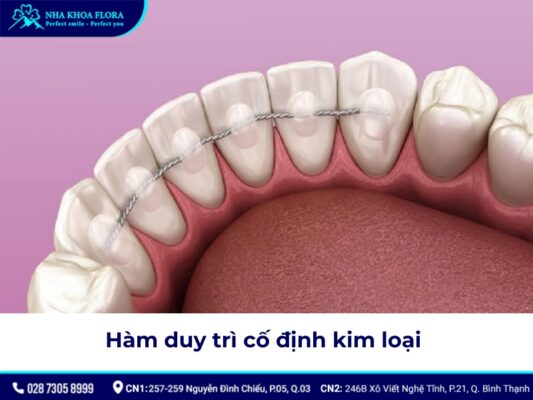 hàm duy trì sau niềng răng - ảnh 4