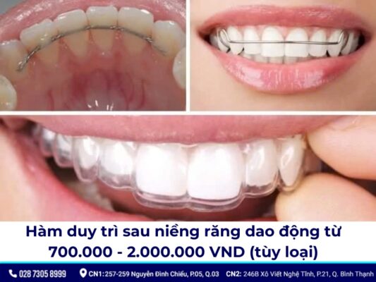 hàm duy trì sau niềng răng - ảnh 5