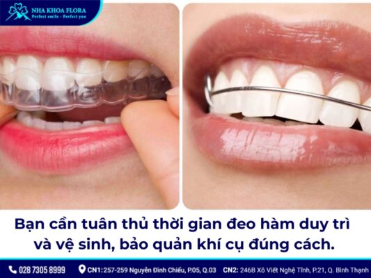 hàm duy trì sau niềng răng - ảnh 6