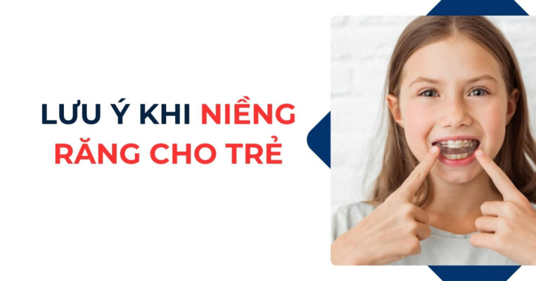 lưu ý khi niềng răng cho trẻ
