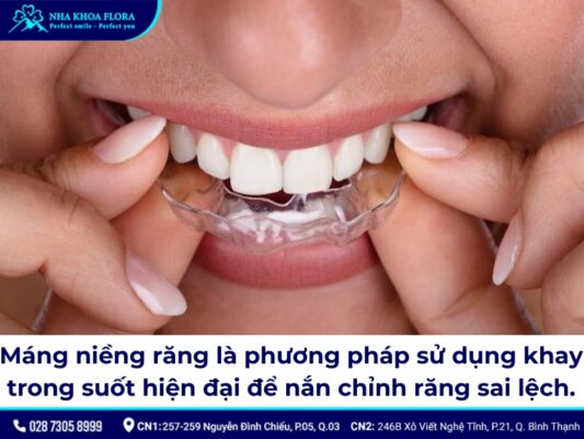 máng niềng răng - ảnh 1