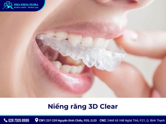 máng niềng răng - ảnh 3