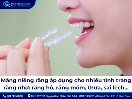 máng niềng răng - ảnh 6