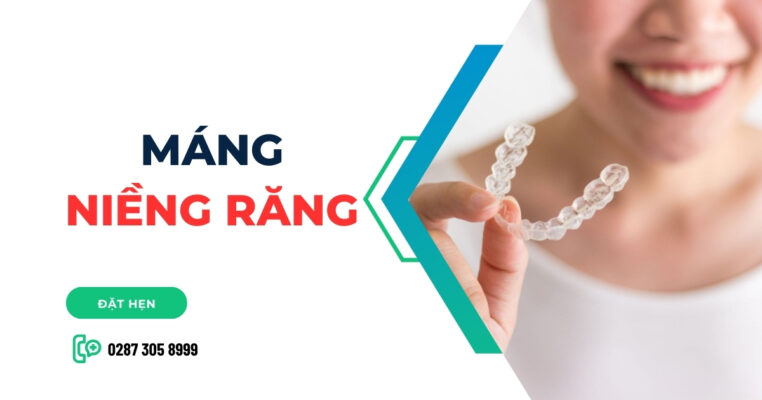 máng niềng răng