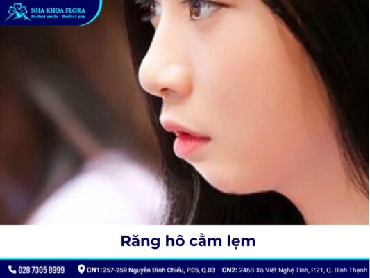 niềng răng hô tại nhà - ảnh 6